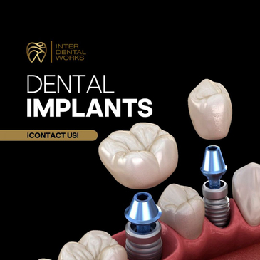 Slider image (2) Inter DentalWorks